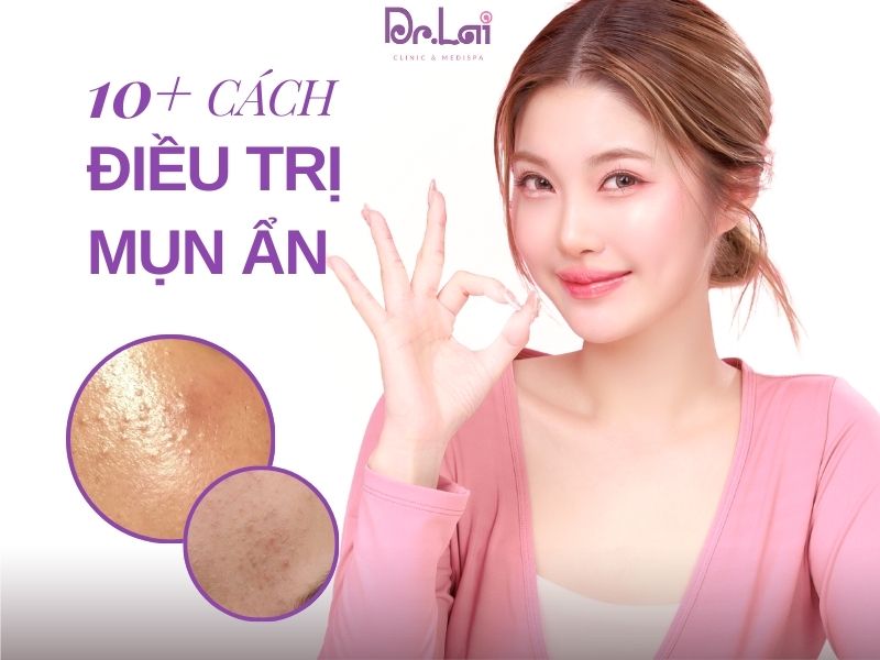 Thâm mụn ẩn