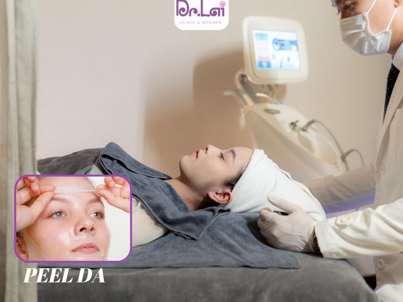 Peel da hóa học